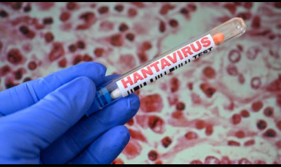 ÜST-dən hantavirusla bağlı  NÖVBƏTİ AÇIQLAMA