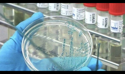 ABŞ-da hantavirus təhlükəsi artır