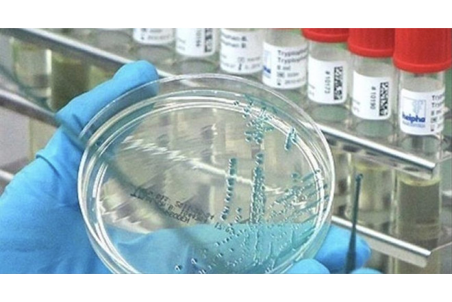 ABŞ-da hantavirus təhlükəsi artır