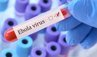 Ebola xəstəliyi Azərbaycanda yayılacaq? - SƏHİYYƏ NAZİRLİYİNİN ƏHALİYƏ MÜRACİƏTİ