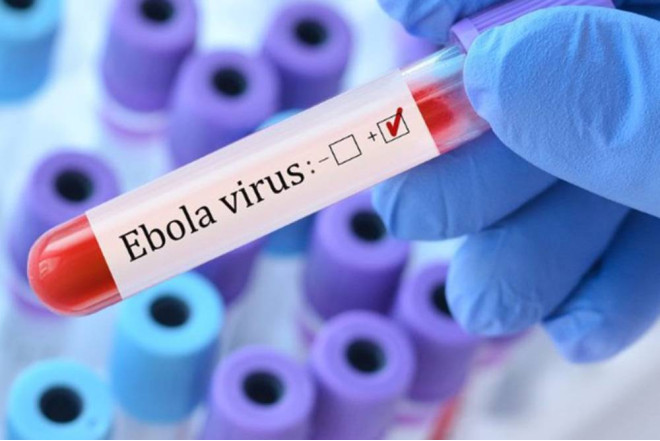 Ebola xəstəliyi Azərbaycanda yayılacaq? - SƏHİYYƏ NAZİRLİYİNİN ƏHALİYƏ MÜRACİƏTİ