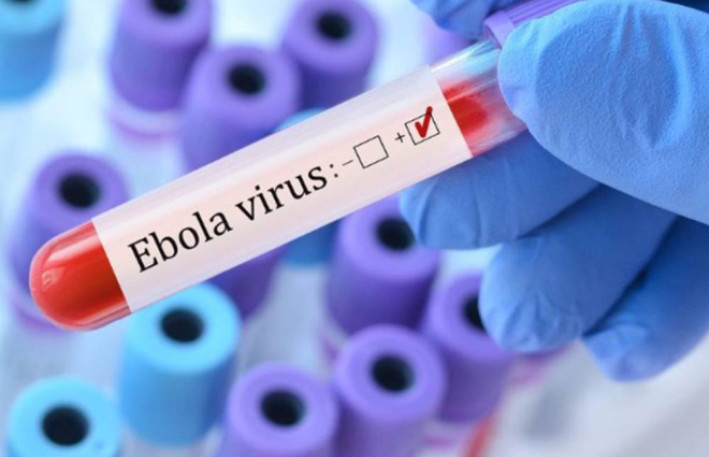 Ebola xəstəliyi Azərbaycanda yayılacaq? - SƏHİYYƏ NAZİRLİYİNİN ƏHALİYƏ MÜRACİƏTİ