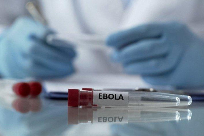 ÜST-dən Ebola ilə bağlı XƏBƏRDARLIQ: Yoluxanların sayı kəskin artır