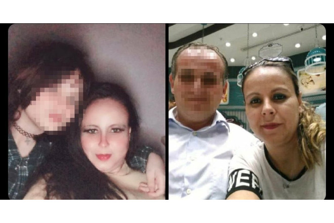 Üzərinə turşu atılan qadın ölüb 