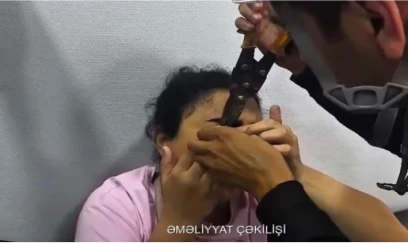 Göz qapağı zəncirbəndə ilişdi, FHN yardım etdi - 