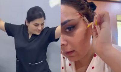“Dr. Gülü” daha bir pasiyenti yarıcan qoyub? - VİDEO