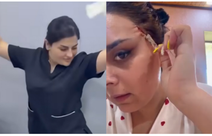 “Dr. Gülü” daha bir pasiyenti yarıcan qoyub? - VİDEO
