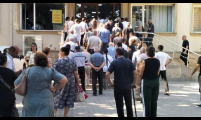 Abşeronun 4 qəsəbəsində rentgen yoxdur: 200 min insan diaqnoz üçün Zabratda növbə tutur