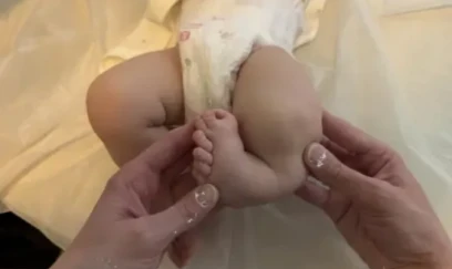 YEDDİ BARMAQLA doğulan körpə əməliyyat olundu