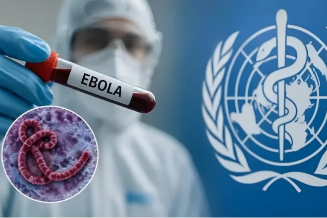 Ebola tarixdə görünməmiş sürətlə yayılır: ÜST-dən HƏYƏCAN TƏBİLİ