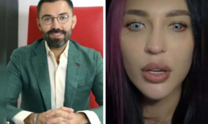 Bakıda göz rəngini dəyişdirdi, görməsi zəiflədi – Moskvalı qadın peşmandır + VİDEO