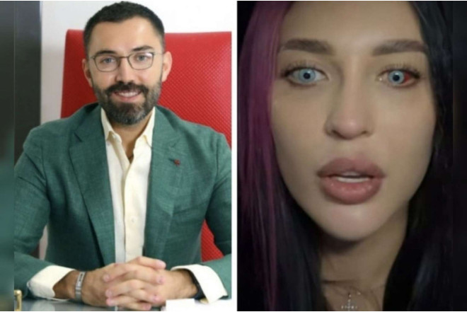 Bakıda göz rəngini dəyişdirdi, görməsi zəiflədi – Moskvalı qadın peşmandır + VİDEO