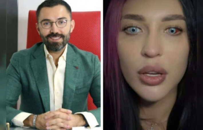 Bakıda göz rəngini dəyişdirdi, görməsi zəiflədi – Moskvalı qadın peşmandır + VİDEO