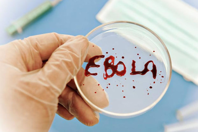 Konqoda Ebola peyvəndinin sınaqlarına başlanılıb 