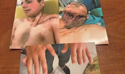 24 yaşlı müharibə iştirakçısına əlillik niyə verilmir? – Politoloqdan sərt REAKSİYA