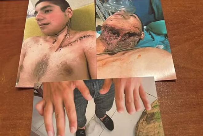 24 yaşlı müharibə iştirakçısına əlillik niyə verilmir? – Politoloqdan sərt REAKSİYA