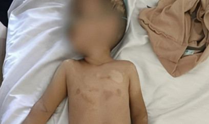 Həmin 3 yaşlı uşağın anasının valideynlik hüququ məhdudlaşdırıla bilər - Foto - Yenilənib 