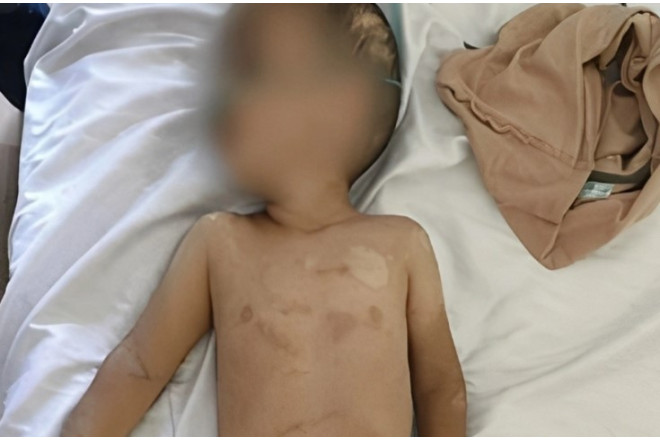 Həmin 3 yaşlı uşağın anasının valideynlik hüququ məhdudlaşdırıla bilər - Foto - Yenilənib 