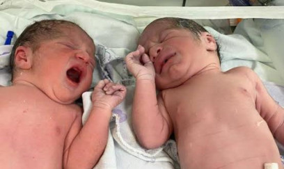 13 yaşlı qız əkiz uşaq dünyaya gətirdi: körpələrdən biri öldü