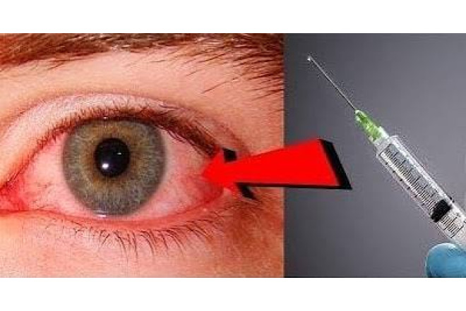 Gözə iynə batırılmasının hansı təhlükələri var? 